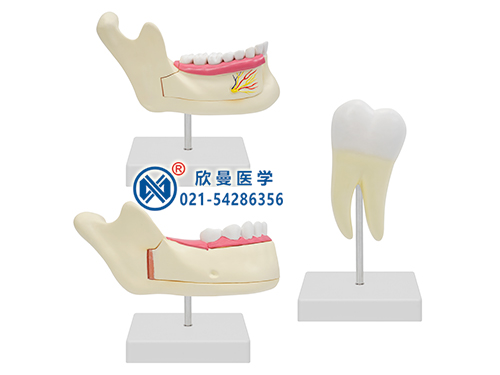 磨牙、乳牙、恒牙模型