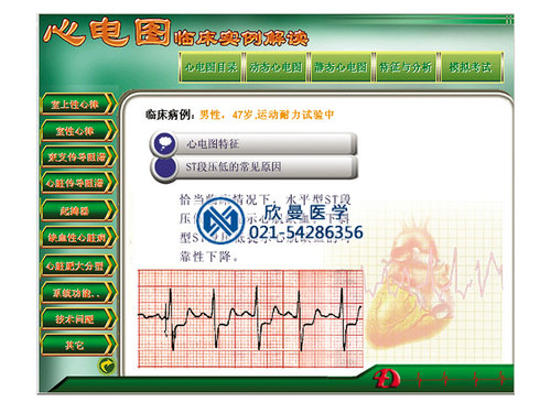 多媒體心電圖教學與考核軟件