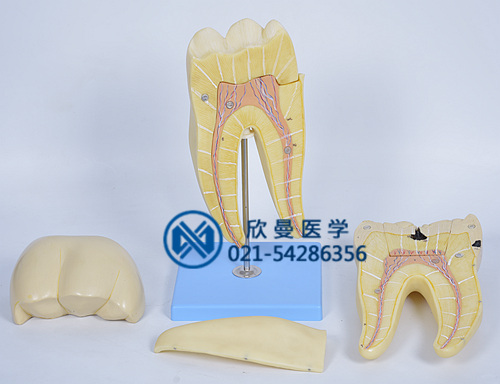 磨牙蛀牙解剖放大模型分解為2部件結構