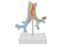 支氣管病理模型