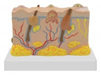 皮膚病變模型